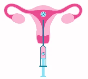 ivf